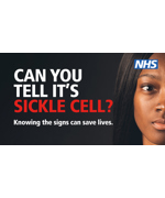 A woman looking forward, text reads "Can you tell it's sickle cell? Knowing the signs can save lives."